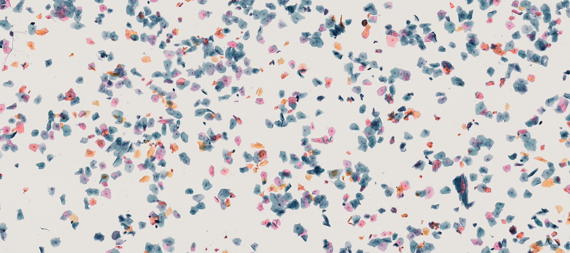 Papanicolaou stain stained epithelial cells, as viewed in a microscope