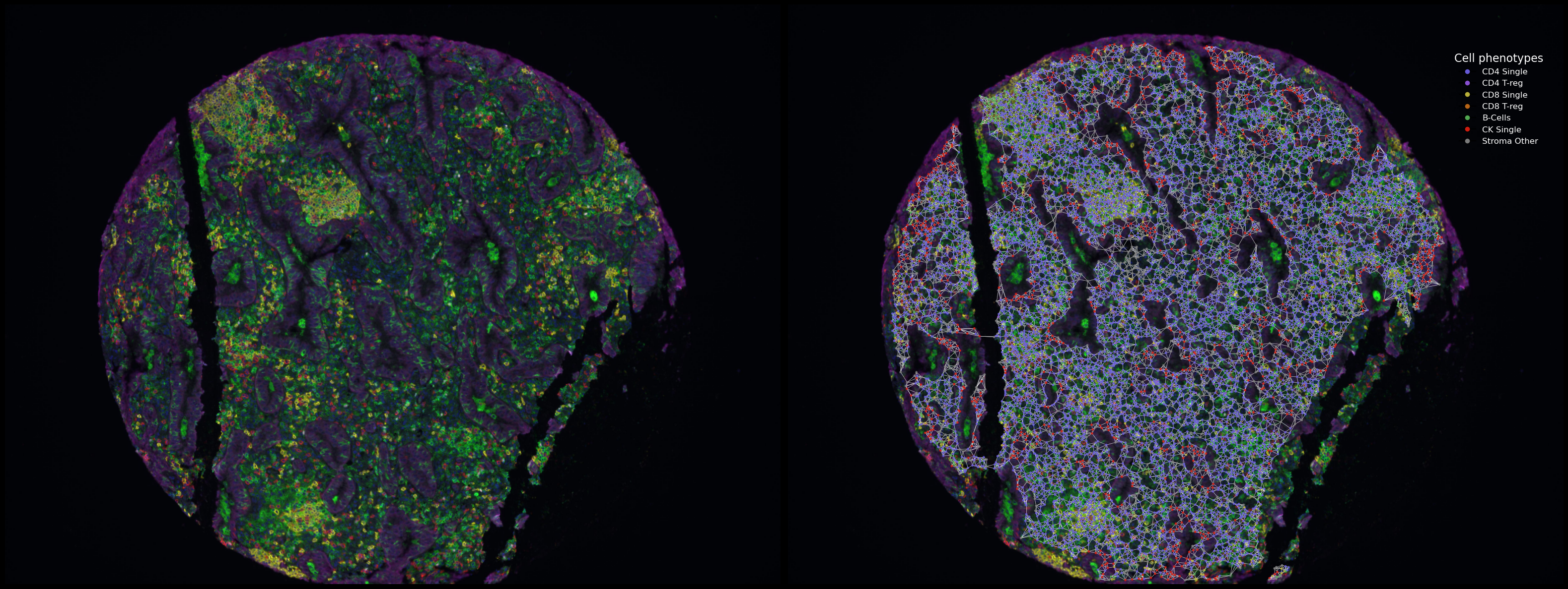 Composite image of a multispectral histology sample and an overlaid cell graph