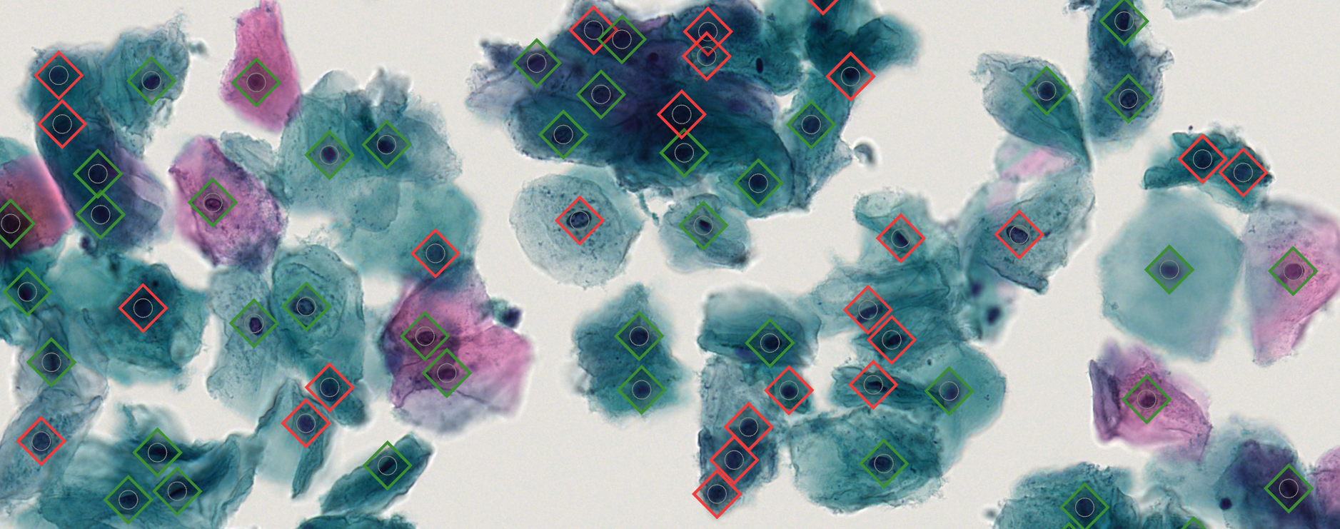 Example of cytology image annotations in CytoBrowser